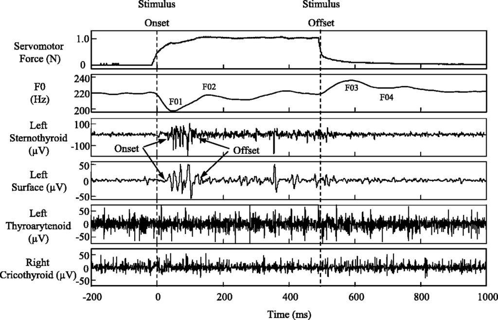 تفسیر نوار عصب و عضله