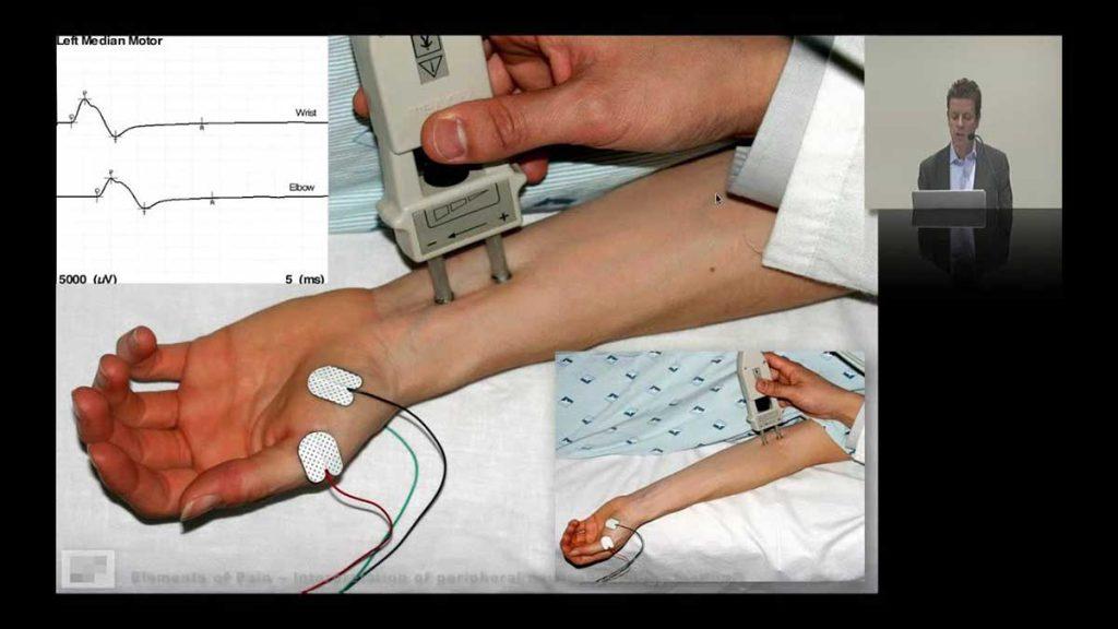 نوار عصب دو اندام در بهترین کلینیک منطقه 2تهران فوری و تخصصی
