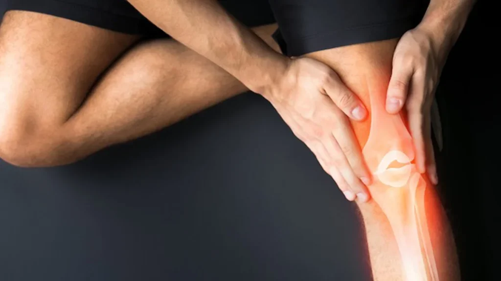 پیشگیری از زانو درد عصبی پیشگیری از زانو درد عصبی