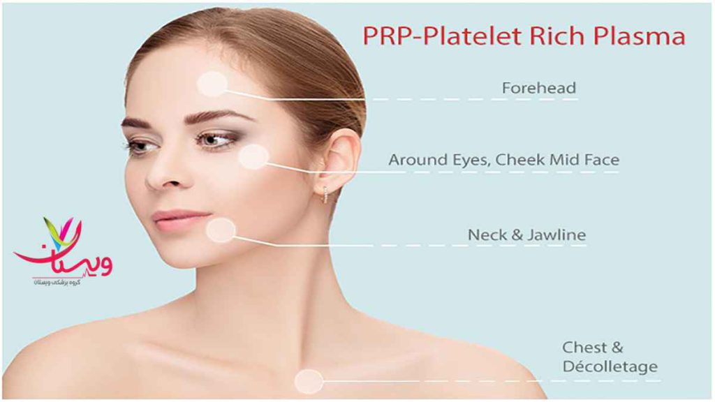 پی آر پی صورت