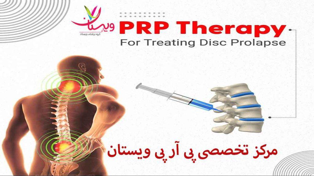 پی آر پی چیست