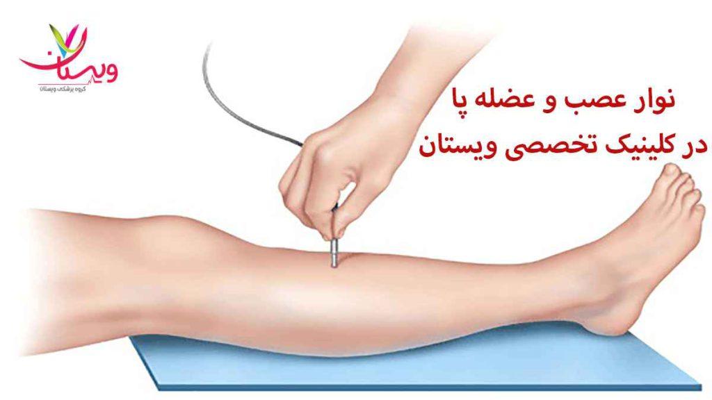 نوار عصب و عضله پا