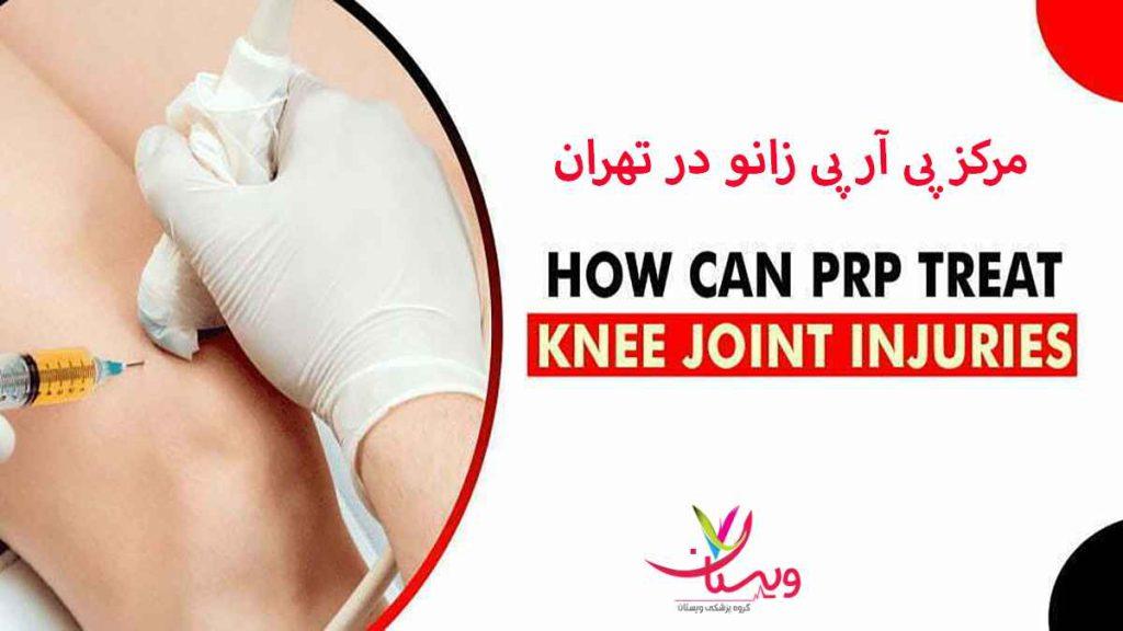 پی آر پی زانو