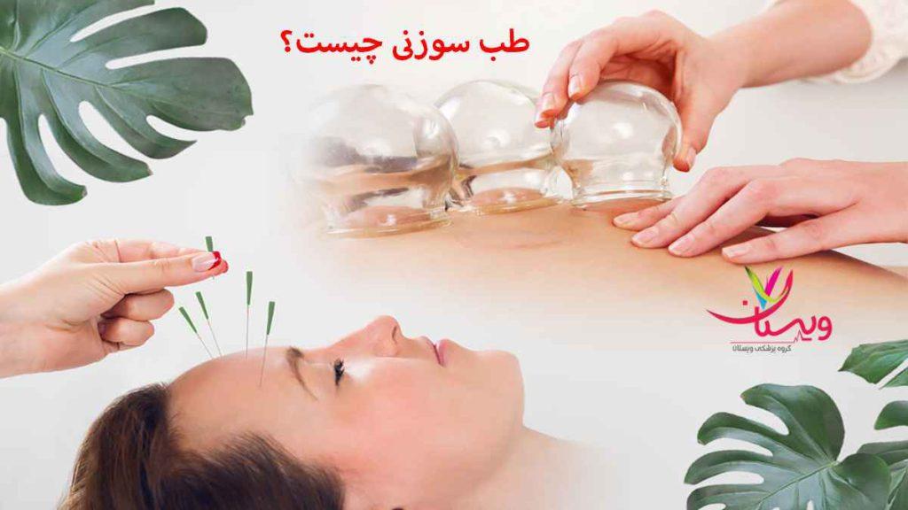 طب سوزنی چیست