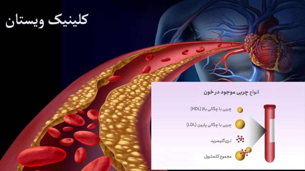 انواع چربی خون انواع چربی خون