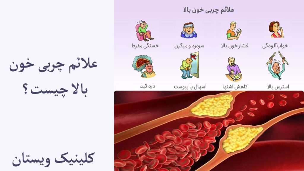 علائم چربی خون علائم چربی خون