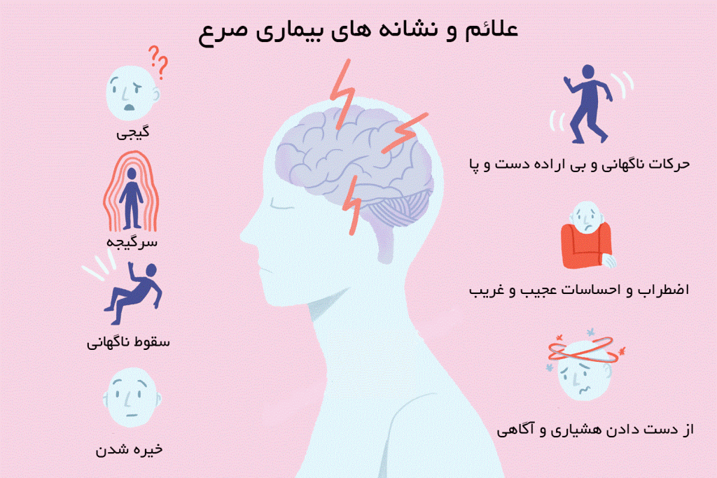 علائم ونشانه های صرع