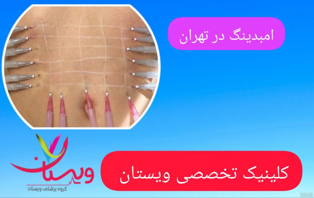 بهترین مرکز امبدینگ تهران