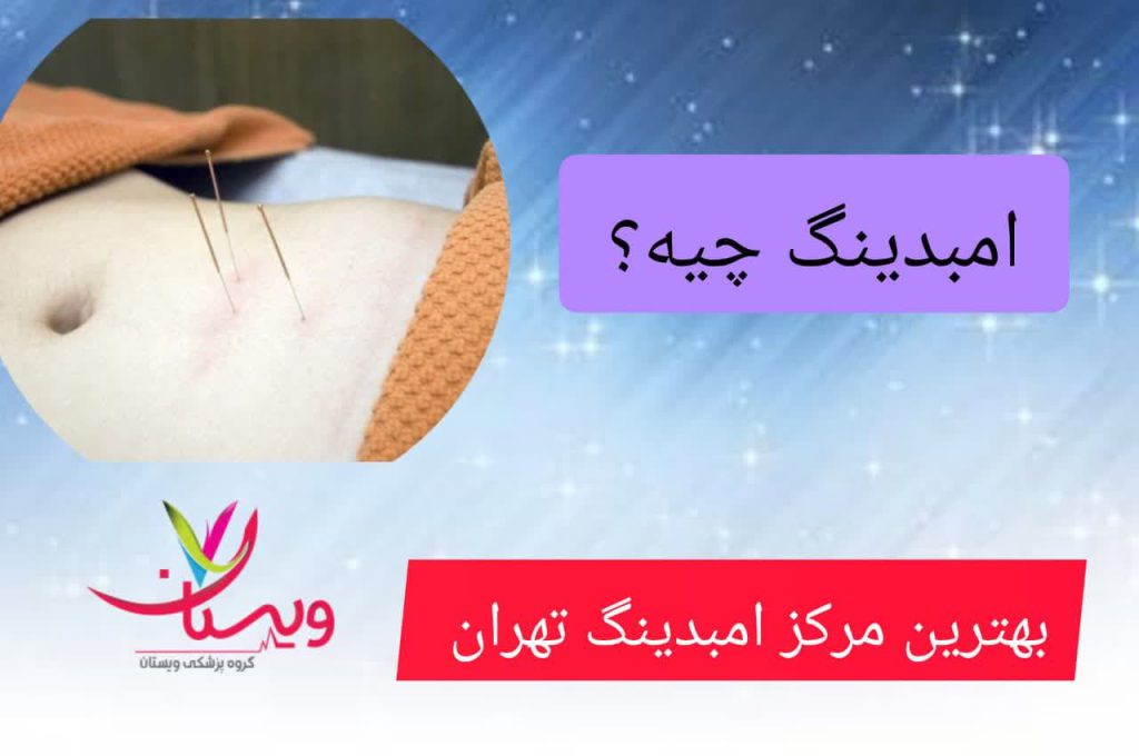 امبدینگ چیه؟