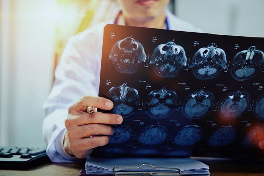 بررسی سی تی اسکن یک بیمار توسط پزشک
