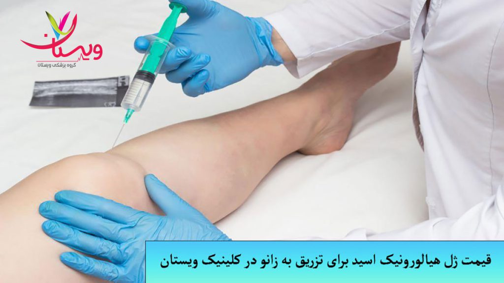 قیمت امپول هیالونیک اسید برای تزریق به زانو