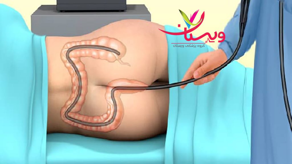 کلینیک کلونوسکوپی معرفی بهترین مرکز کلونوسکوپی در تهران