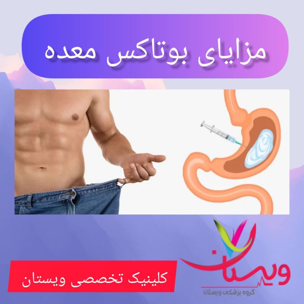 مزایای بوتاکس معده مزایای بوتاکس معده