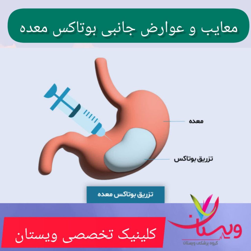 معایب و عوارض جانبی بوتاکس معده معایب و عوارض جانبی بوتاکس معده