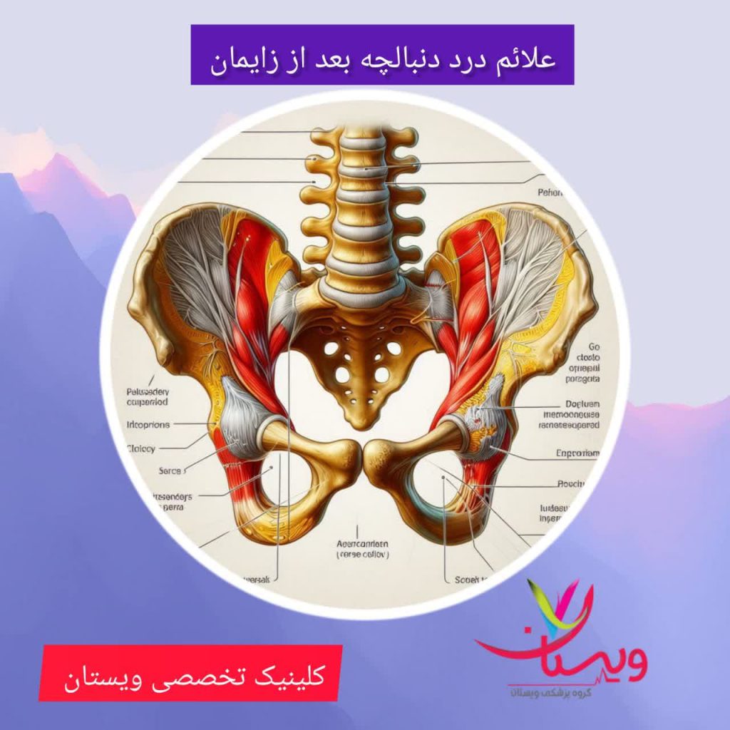 علائم درد دنبالچه بعد از زایمان علائم درد دنبالچه بعد از زایمان