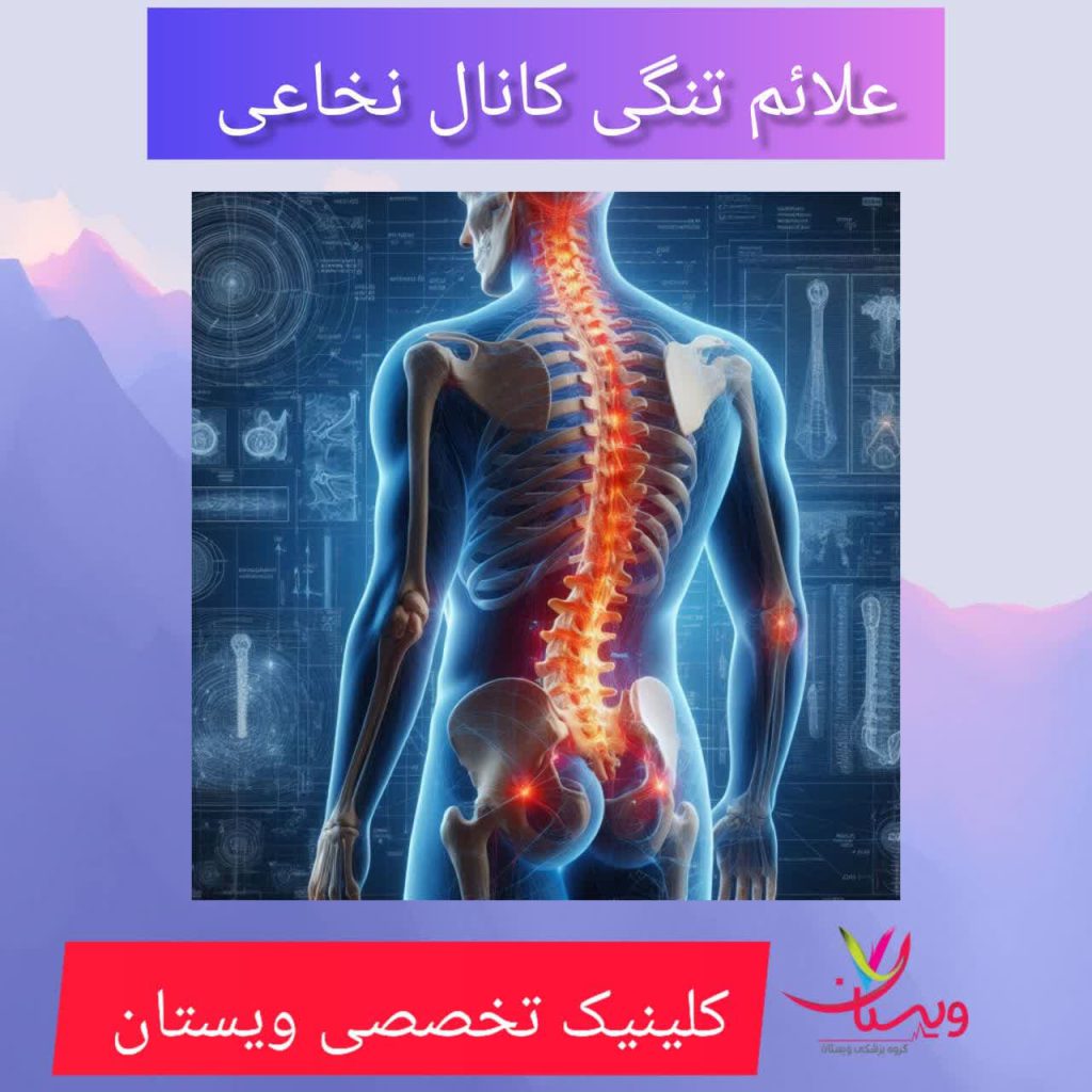 علائم تنگی کانال نخاعی
