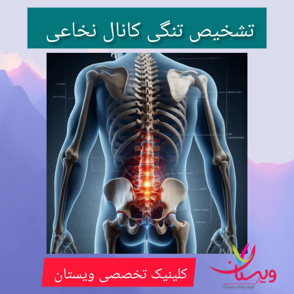 تشخیص تنگی کانال نخاعی