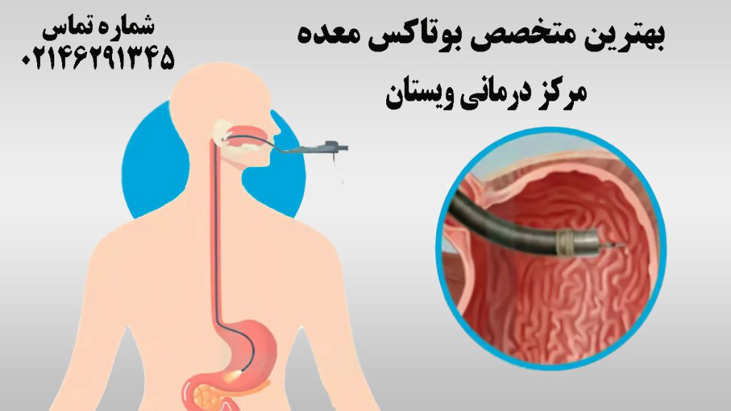 تصویر انیمیشنی از بوتاکس و آندوسکوپی معده