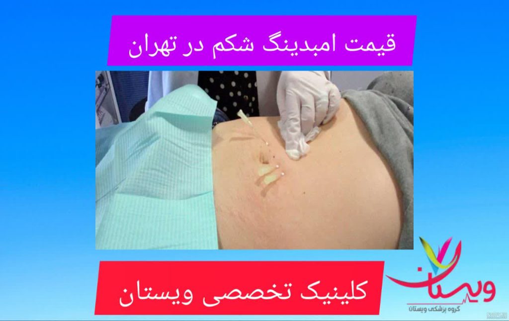قیمت امبدینگ شکم در تهران قیمت امبدینگ شکم در تهران