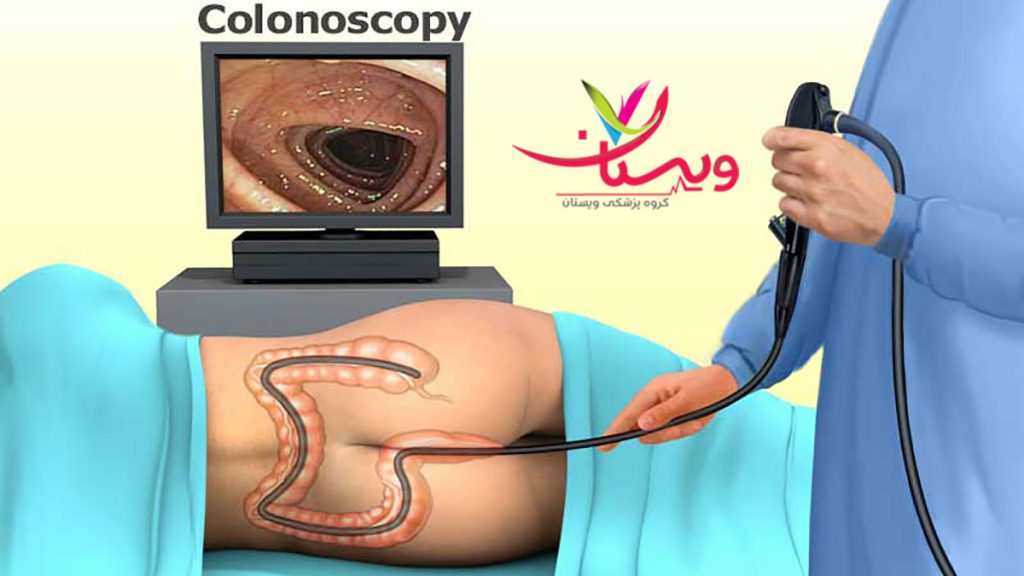 هزینه و قیمت کلونوسکوپی