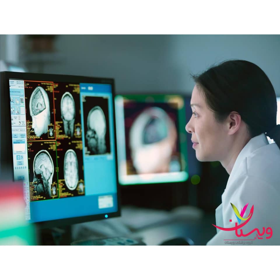 متخصص مغز و اعصاب کیست؟ متخصص مغز و اعصاب کیست؟