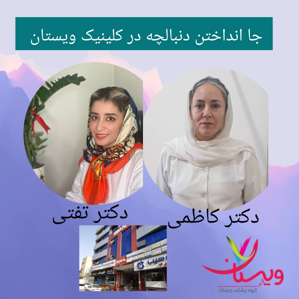 جا انداختن دنبالچه در کلینیک ویستان جا انداختن دنبالچه در کلینیک ویستان
