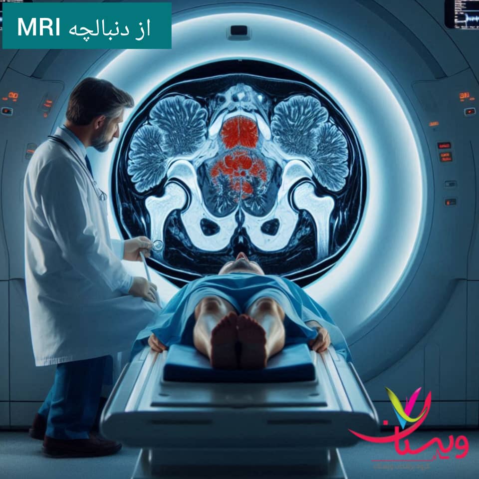 تصویر برداری از دنبالچه تصویر برداری از دنبالچه