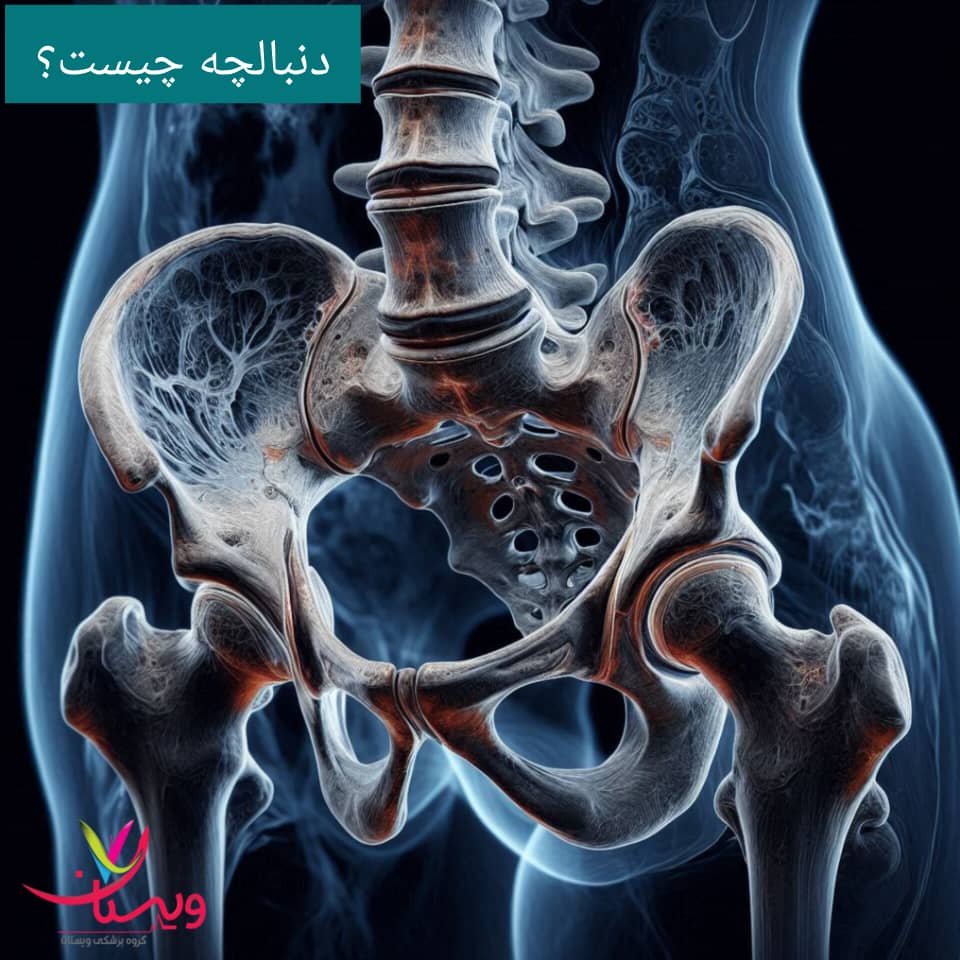 دنبالچه چیست دنبالچه چیست