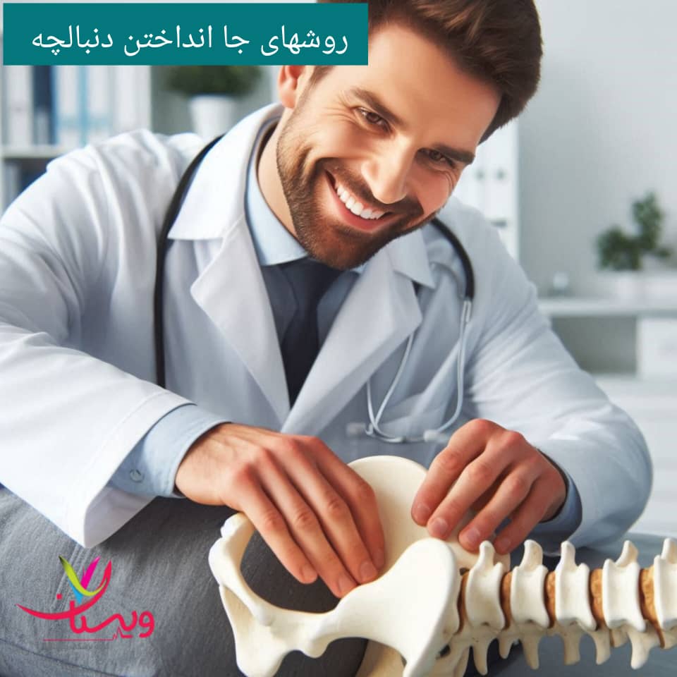 روش های جا انداختن دنبالچه