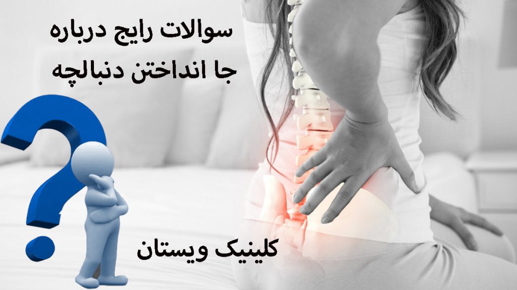 درباره جا انداختن دنبالچه تصویری از کمر یک خانم که درد دارد