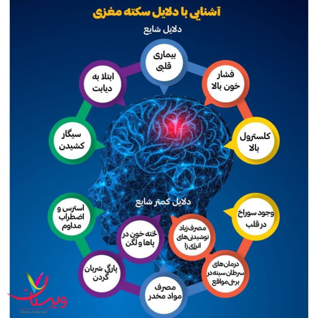 علت سکته مغزی علت سکته مغزی