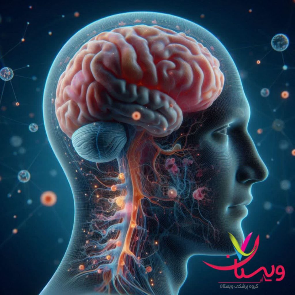 سکته مغزی سکته مغزی