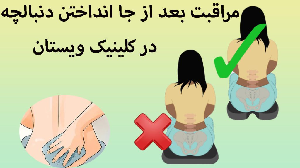 مراقبت بعد از جا انداختن دنبالچه سه تصویر مختلف در یک قاب از مراثبت های دنبالچه