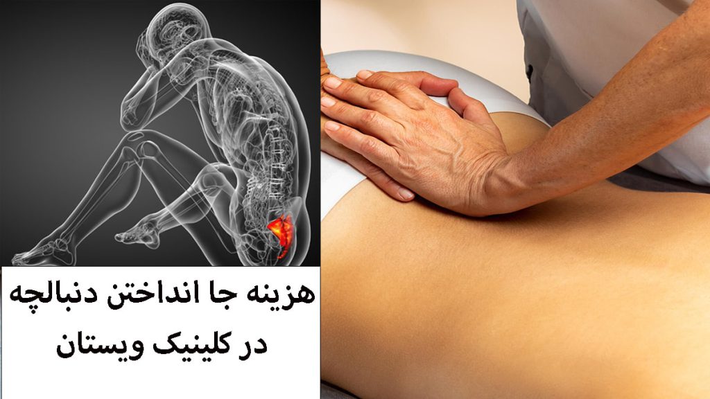هزینه جا انداختن دنبالچه پزشک در حال جا انداختن دنبالچه-نوشته درباره هزینه جا انداختن دنبالچه