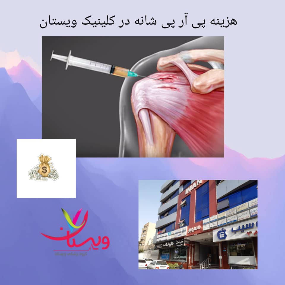 هزینه پی آر پی شانه در کلینیک ویستان