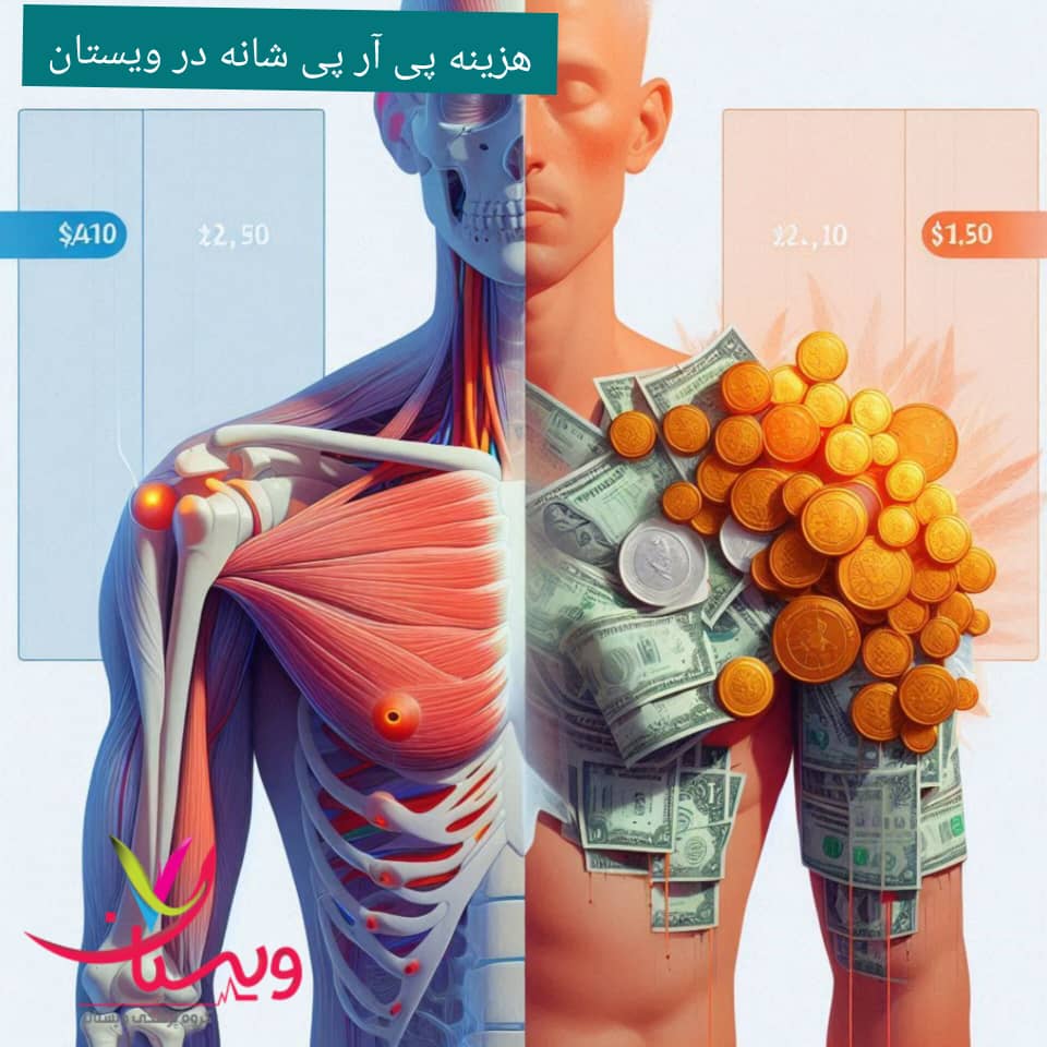 هزینه پی آر پی شانه در کلینیک ویستان هزینه پی آر پی شانه در کلینیک ویستان