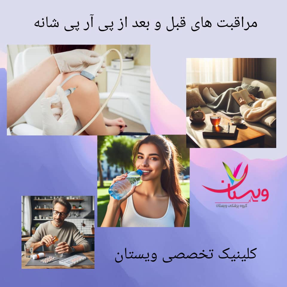 مراقبتهای قبل و بعد از پی آر پی شانه مراقبتهای قبل و بعد از پی آر پی شانه