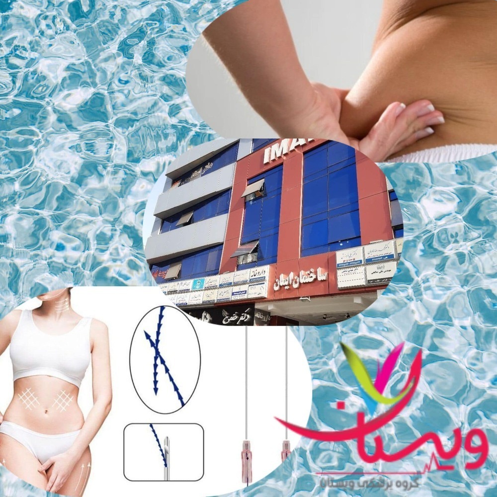 بهترین مرکز امبدینگ در تهران