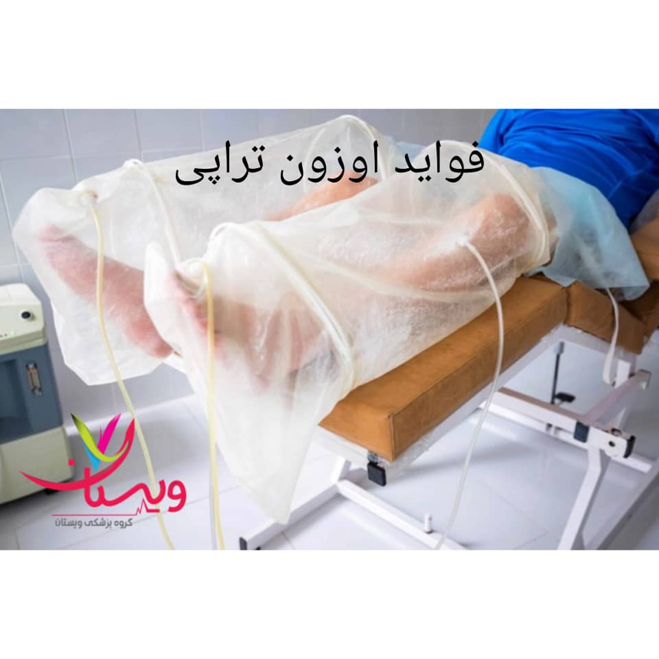 فواید اوزون تراپی فواید اوزون تراپی