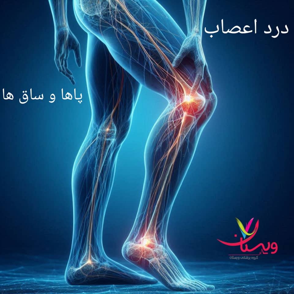 درد عصبی در پاها و ساق‌ها