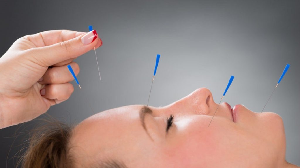 طب سوزنی طب سوزنی