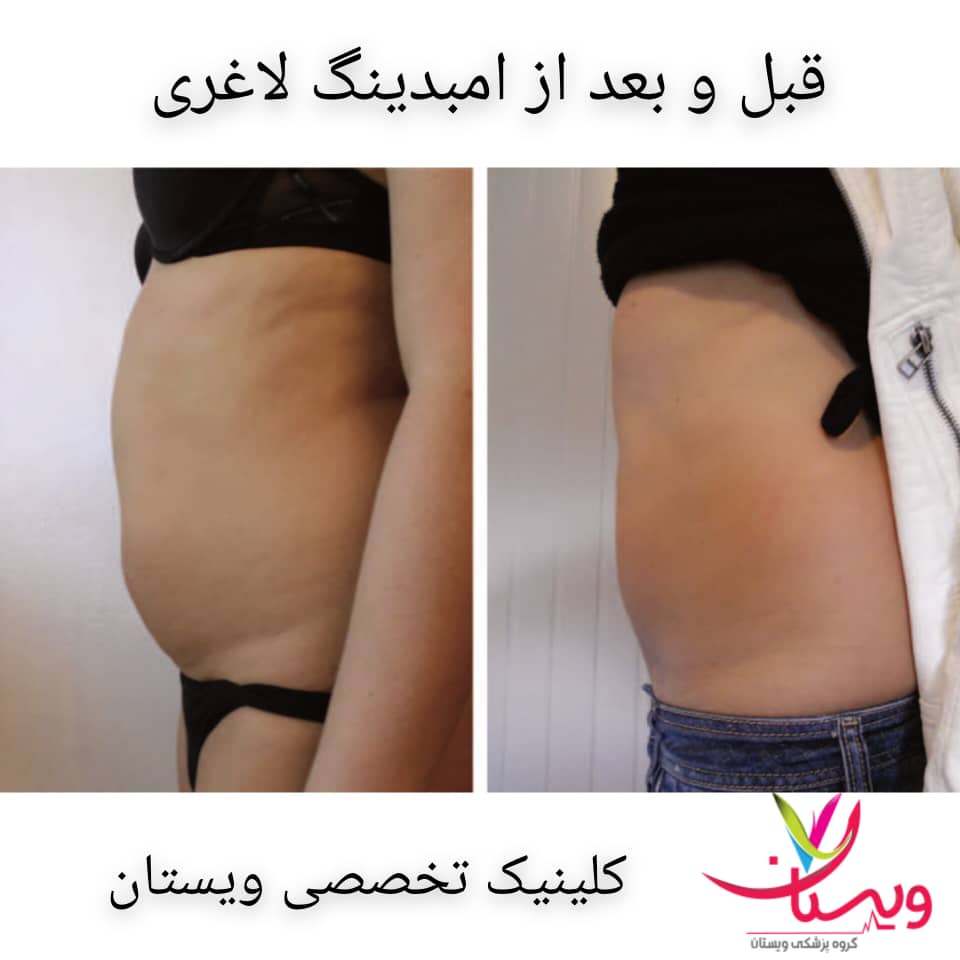 نکات قبل و بعد از امبدینگ