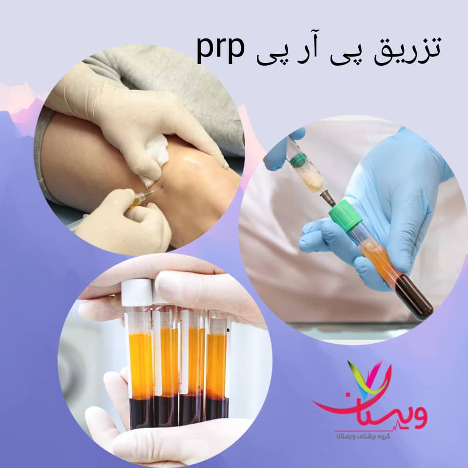 تزریق پی آر پی