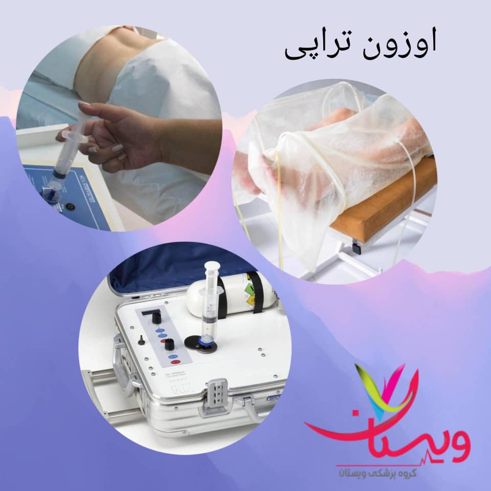 اوزون‌تراپی