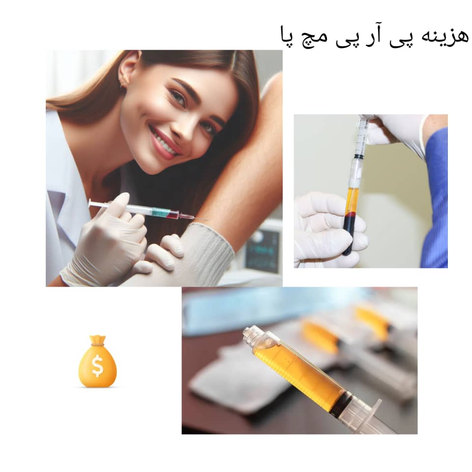 هزینه پی آر پی مچ پا هزینه پی آر پی مچ پا