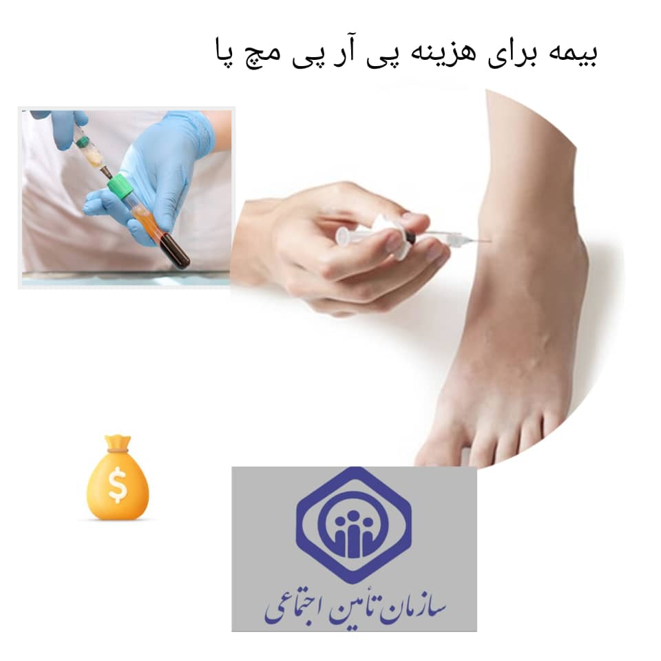 بیمه برای هزینه پی آر پی مچ پا بیمه برای هزینه پی آر پی مچ پا