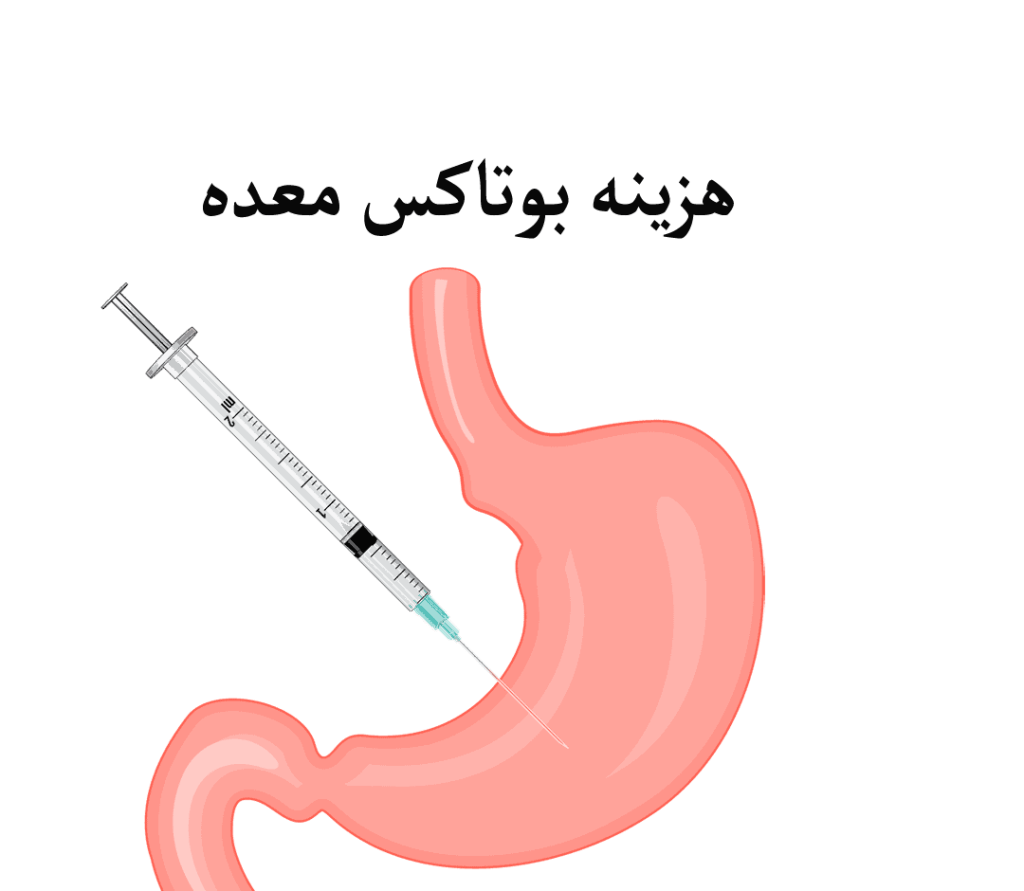 هزینه بوتاکس معده در سال ۱۴۰۲