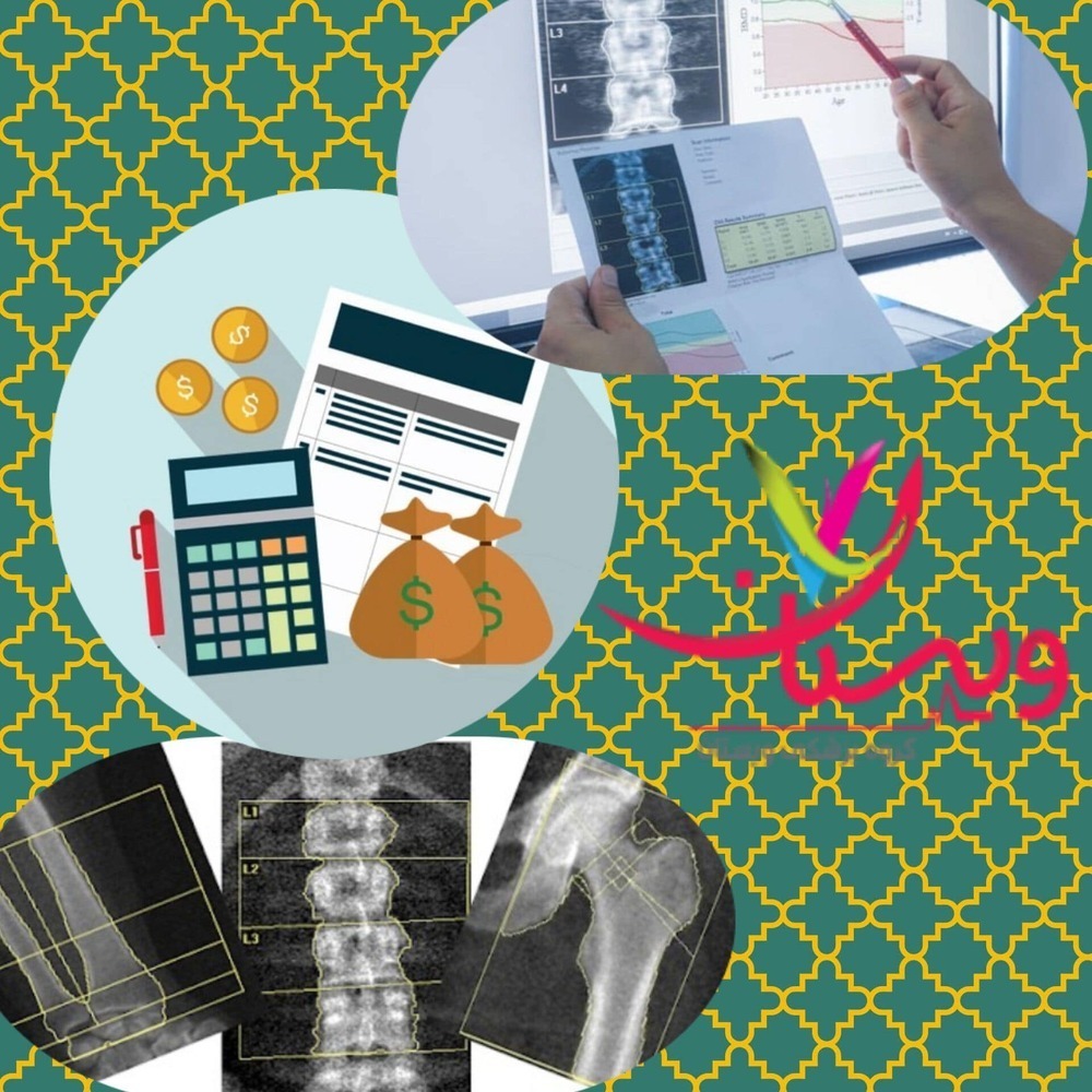 هزینه آزمایش تراکم استخوان 1403+ازمایش تراکم استخوان با بیمه