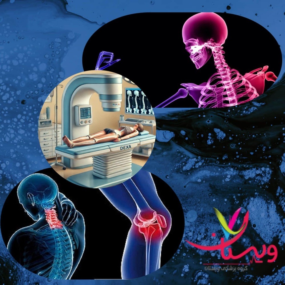 بهترین مراکز سنجش تراکم استخوان تهران 1403+مراکز غرب تهران