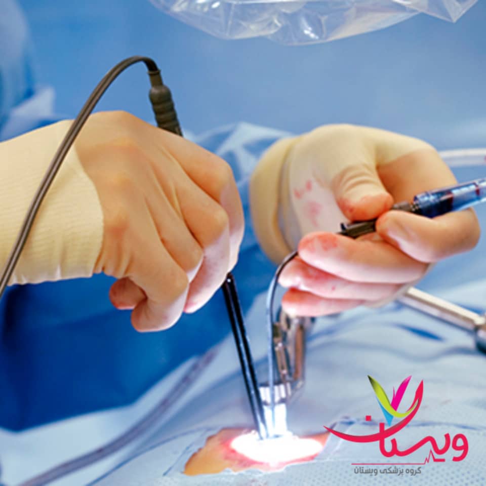 عمل باز دیسک کمر عمل باز دیسک کمر